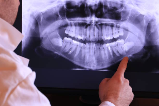 Best Emergency Treatment for Dental Infections or Abscesses in , DE